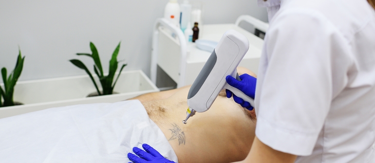 PICO ლაზერი